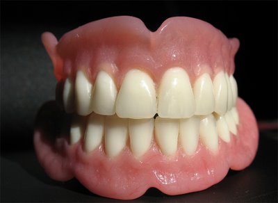 protesis-dentales1